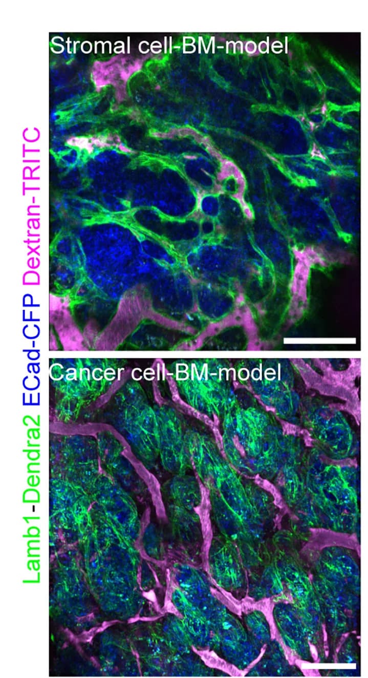 Open access visualization of Microscopy, Blood vessels, Tumor, Stromal-cell-BM model, Cancer-cell-BM model