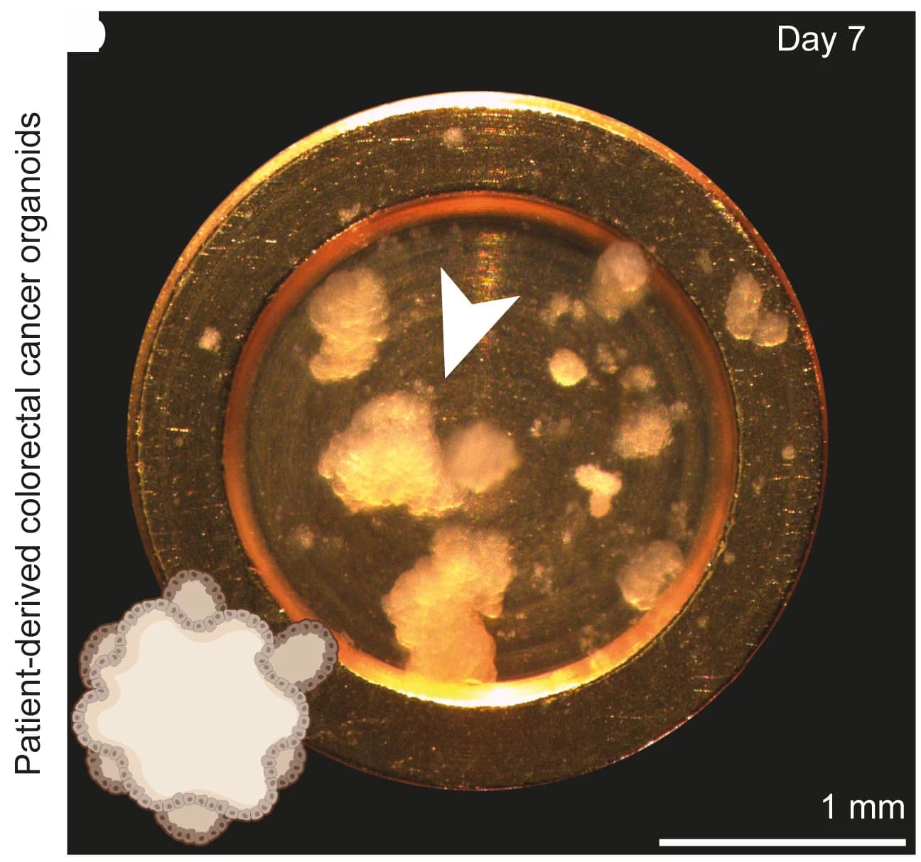 Open access visualization of Microscopy, Illustration, Patient-Derived Colorectal Cancer Organoids, HPF Carriers, Stereomicroscopy