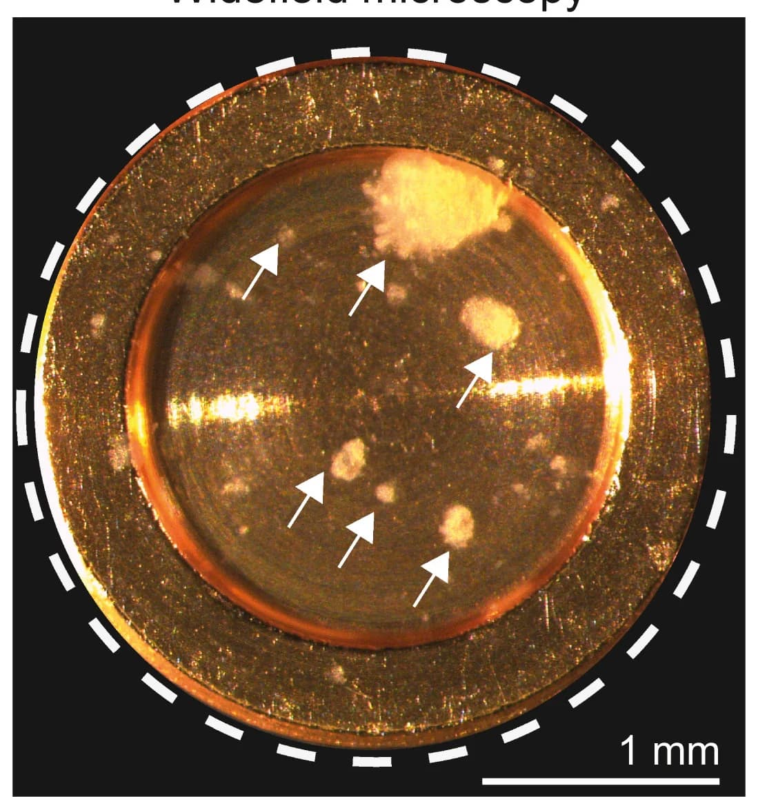 Open access visualization of Microscopy, Photo, Patient-Derived Colorectal Cancer Organoids, Light Microscopy, High-Pressure Freezing
