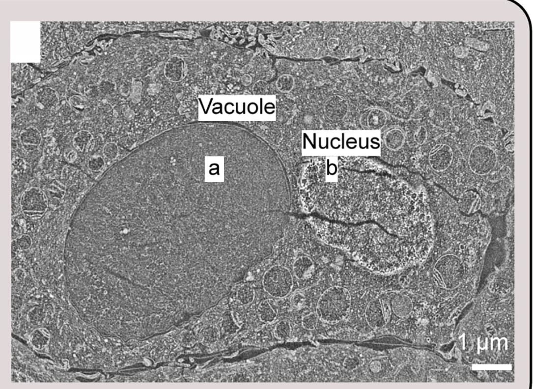 Open access visualization of Microscopy, Correlated Light and Electron Microscopy, Post-Embedding Fluorescence, SEM Imaging, Vacuole