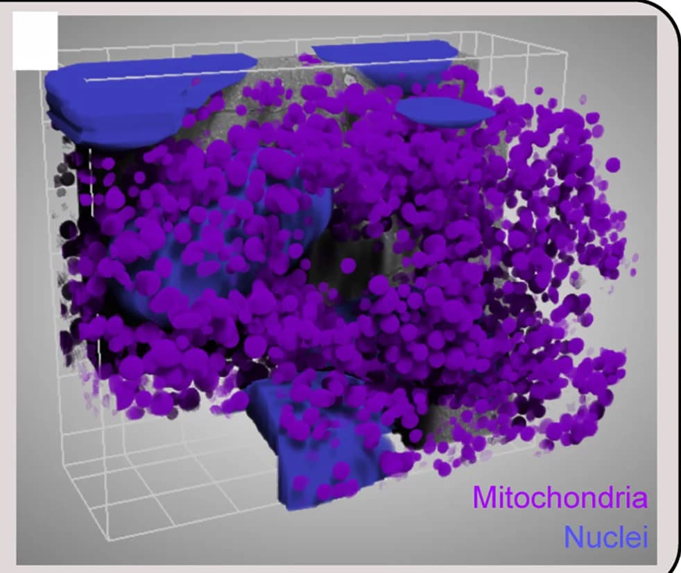 Open access visualization of 3D Plot, 3D Representation, FIB-SEM Acquisition, Mitochondria