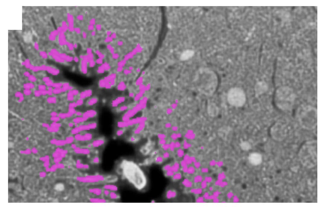 Open access visualization of Microscopy, Segmentation, Actin Bundles, Microvilli
