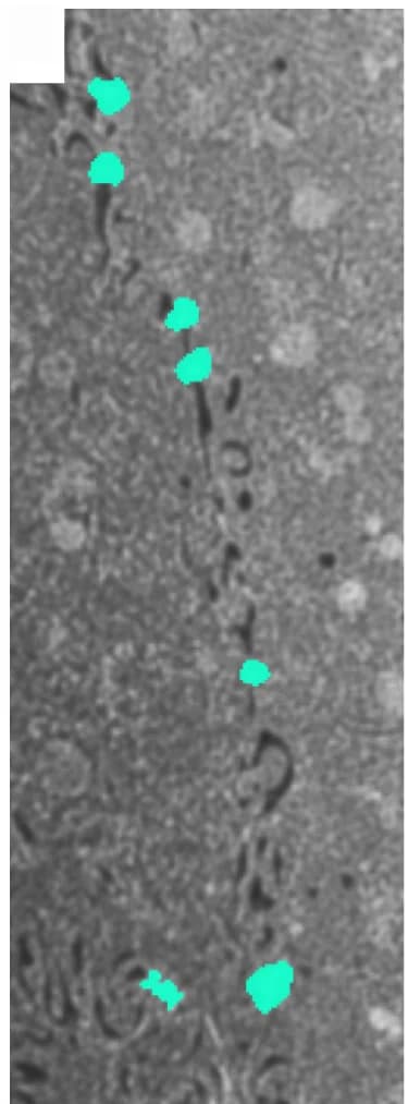 Open access visualization of Microscopy, Segmentation, Cell Junctions, Desmosomes