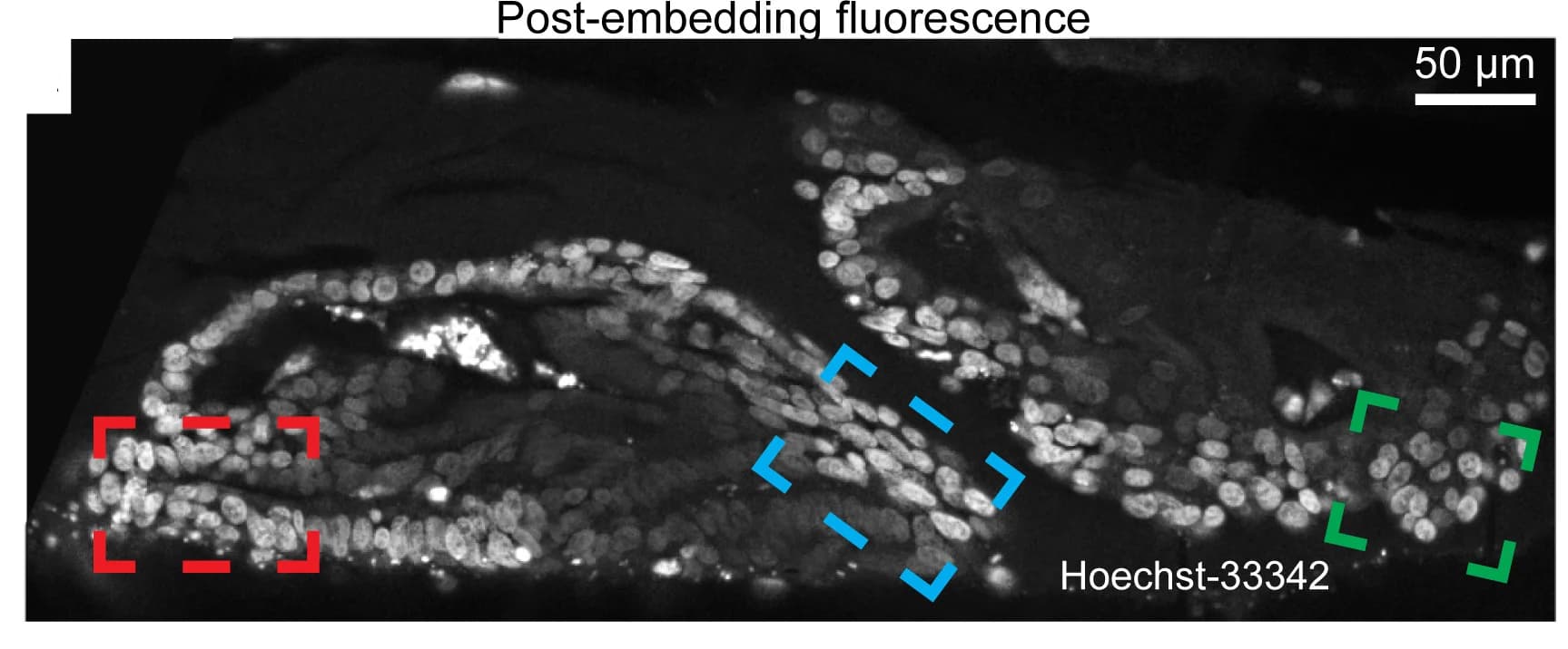 Open access visualization of Microscopy, Colorectal Cancer Organoids, Cell Nuclei, FIB-SEM, Cell Packing Morphologies