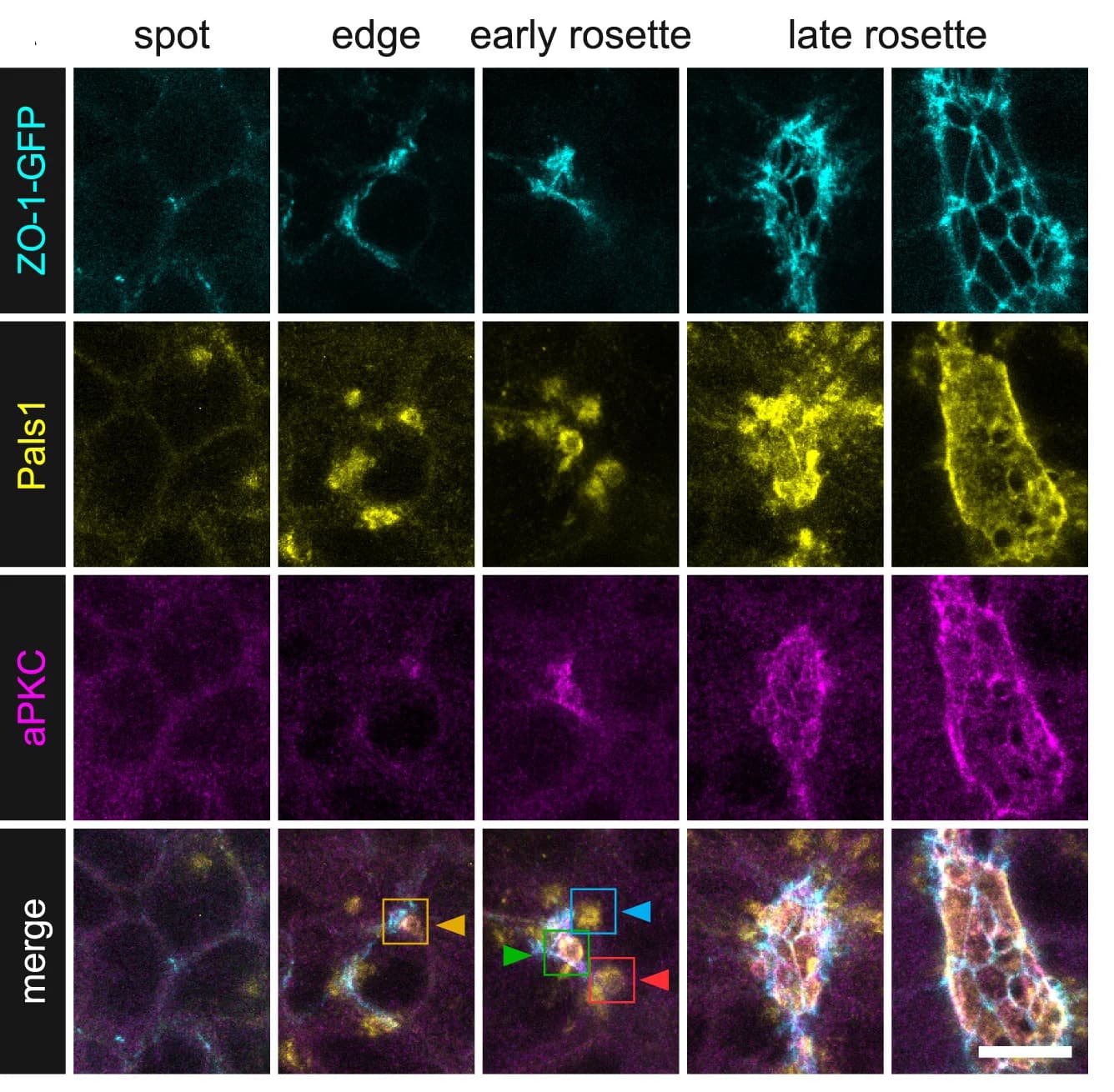 Open access visualization of Microscopy, ZO-1-GFP, Pals1, aPKC, Rosette Formation
