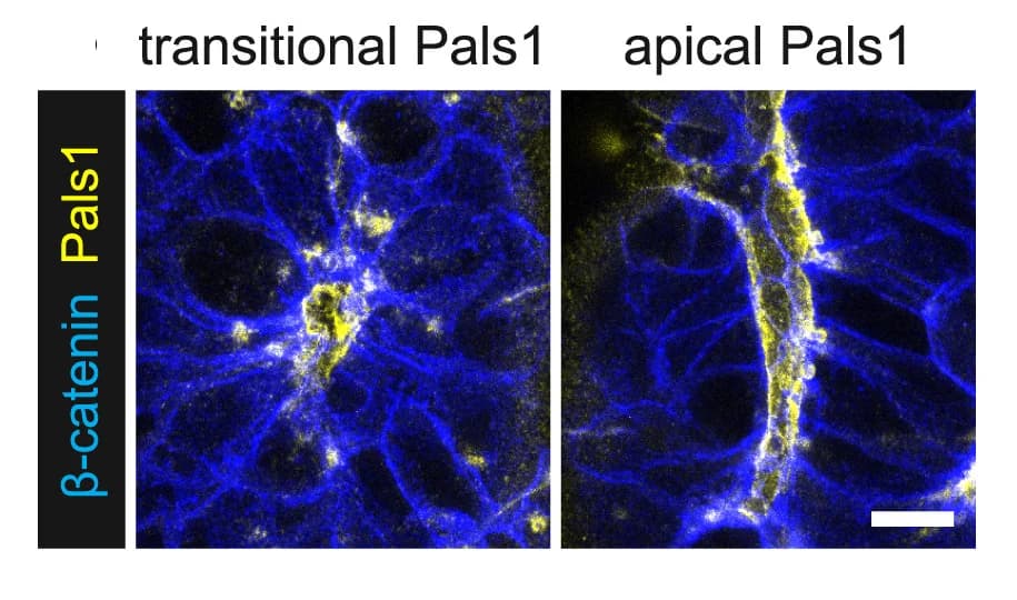 Open access visualization of Microscopy, Pals1, Beta-catenin, Late Rosettes