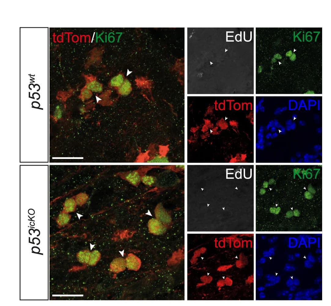 Open access visualization of Microscopy, Immunostaining, EdU- Ki67+ tdTom+ Type-C Cells, p53wt, p53icKOSVZ