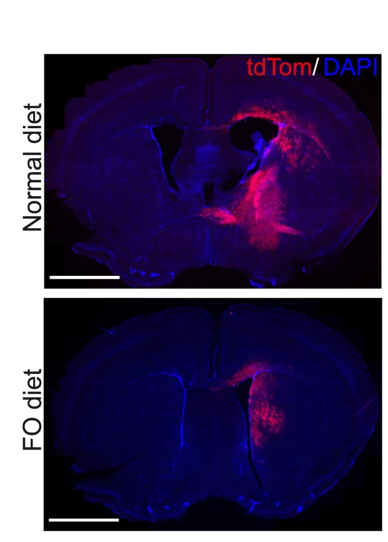 Open access visualization of Microscopy, tdTom-Labeled Tumors, Normal Diet, FO-supplemented Diet, Representative Images