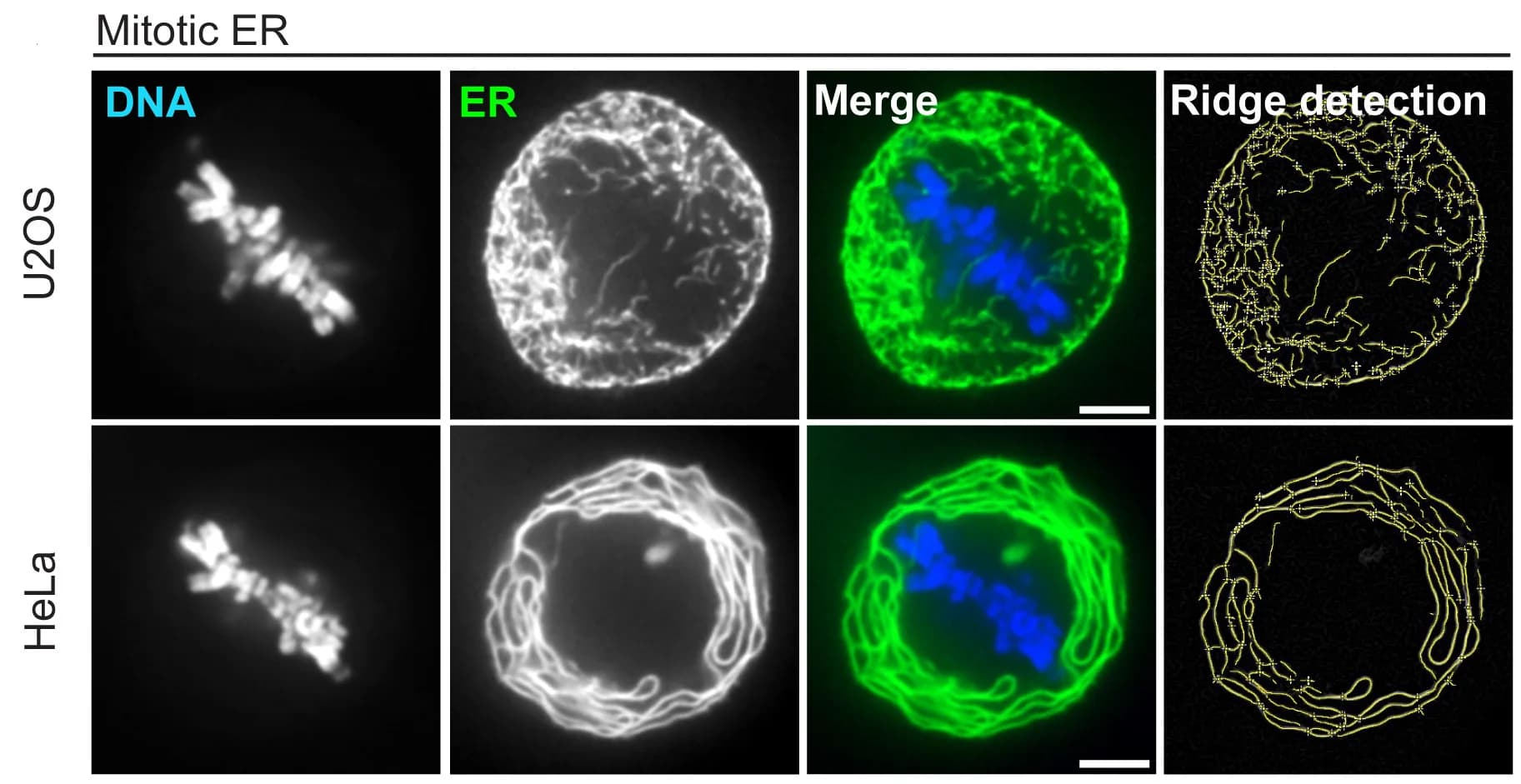 Open access visualization of Microscopy, Live-cell images, ER, Metaphase, U2OS Cells