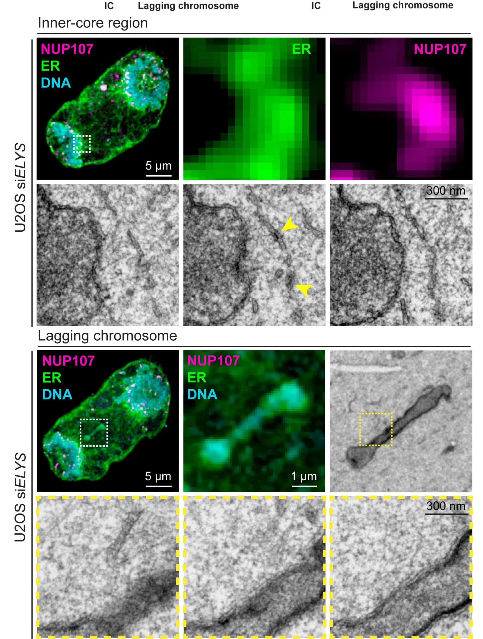 Open access visualization of Microscopy, CLEM, AL Formation, Lagging Chromosomes, U2OS Cells