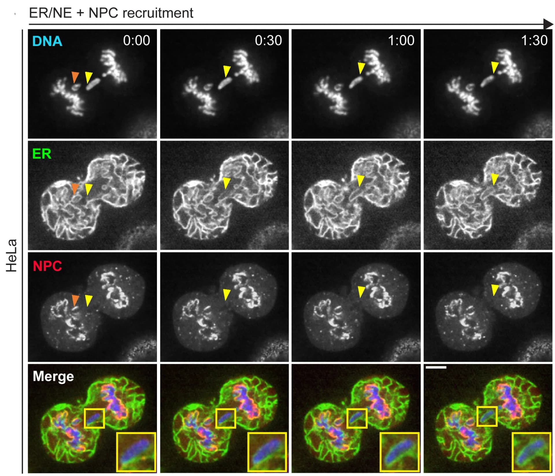 Open access visualization of Microscopy, NE, NPC, HeLa Cells, Lagging Chromosome