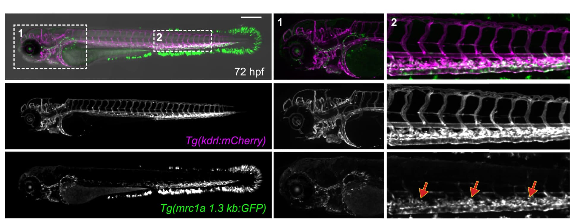 Open access visualization of Microscopy, Embryo, Endothelial Cells, Transgene, Vascular GFP Expression