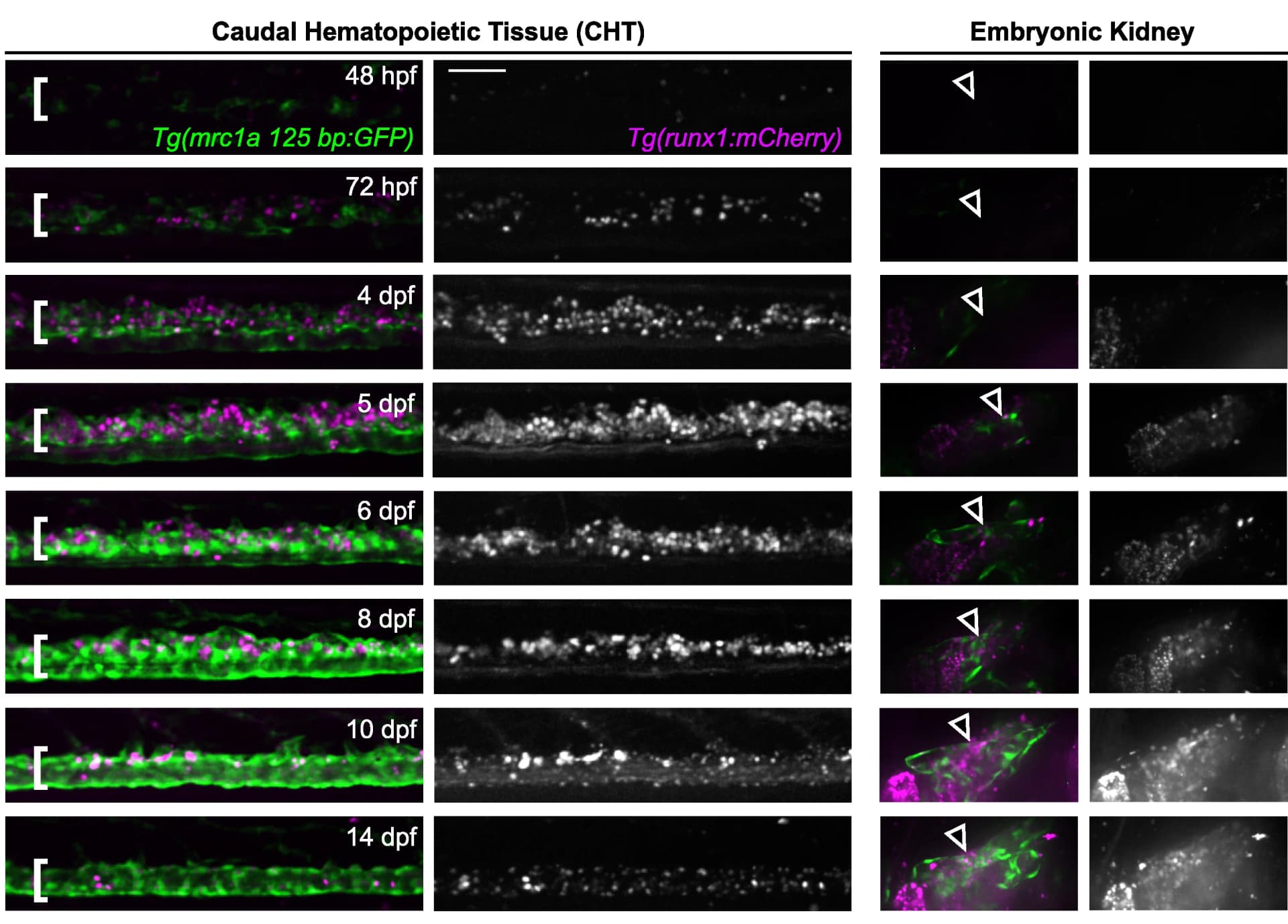 Open access visualization of Microscopy, GFP Expression, mCherry Expression, CHT, Kidney
