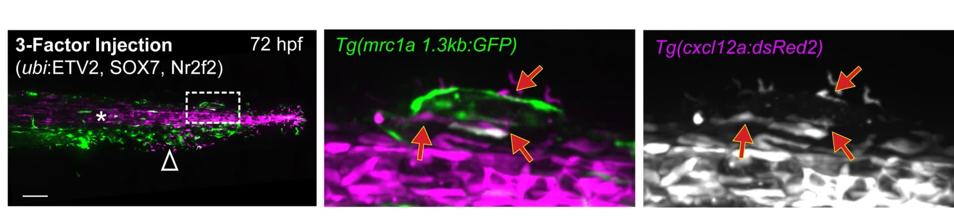 Open access visualization of Microscopy, ECs, mrc1a 1.3kb:GFP, cxcl12a:dsRed2+stromal cells, CHT