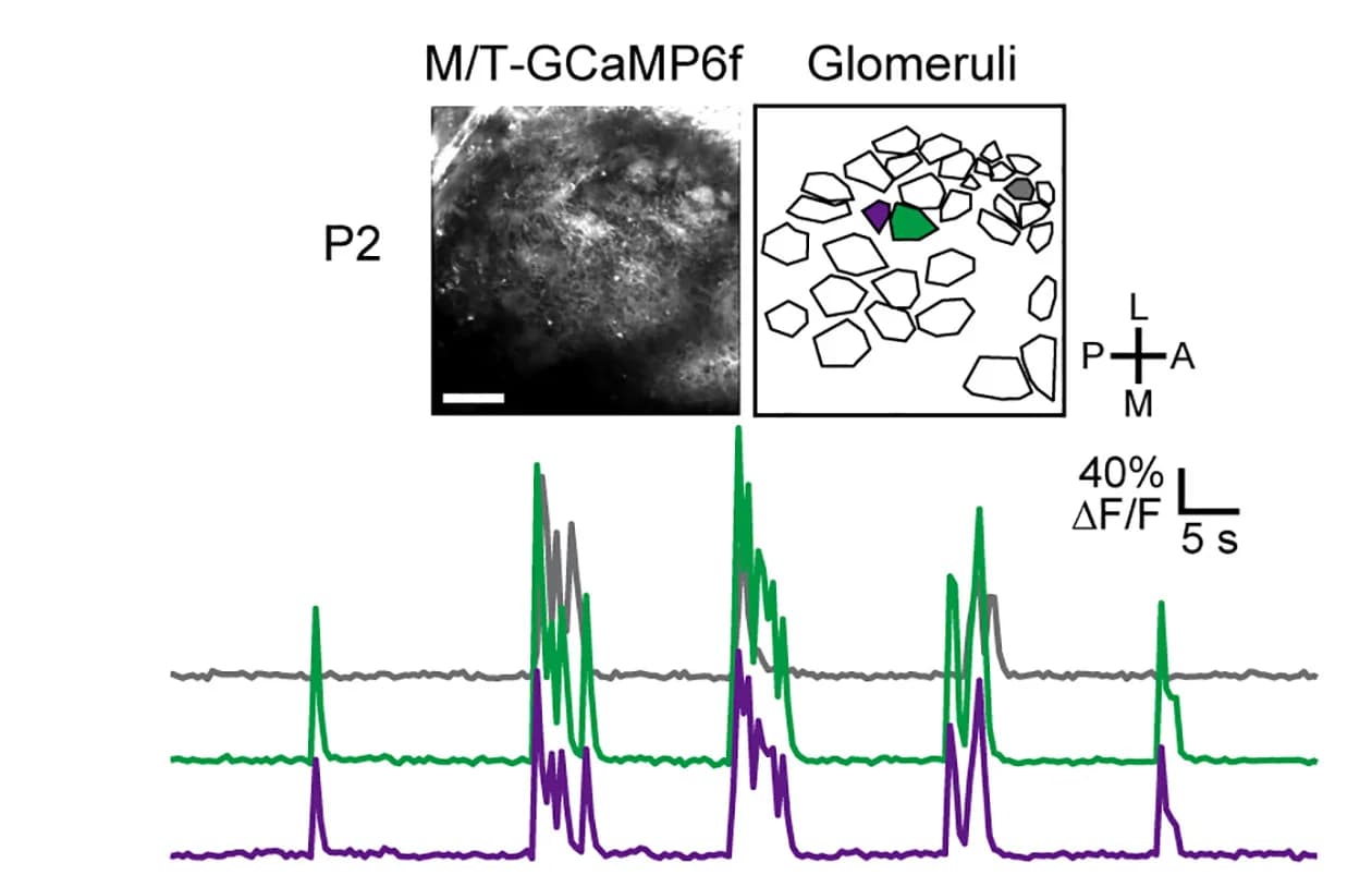 Open access visualization of Line Plot, Microscopy, Illustration, P2 Imaging, Glomeruli