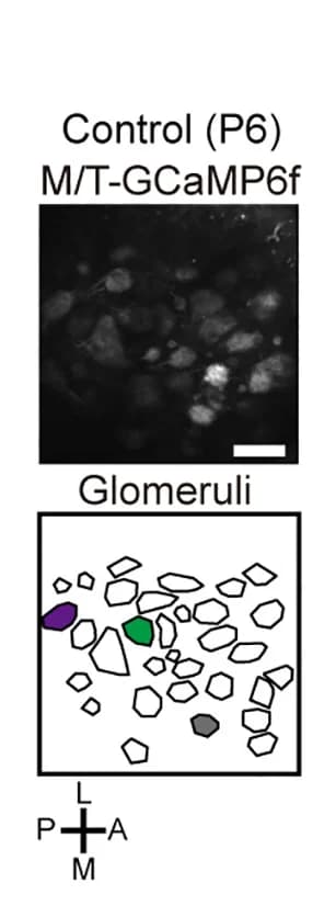 Open access visualization of Microscopy, Illustration, M/T-TeNT Mice, M/T-GCaMP6f Mice, Neuronal Activity