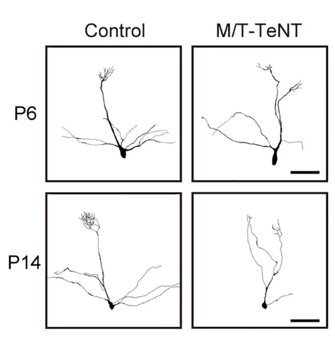 Open access visualization of Microscopy, Dendritic Reconstructions, M/T-TeNT Mice