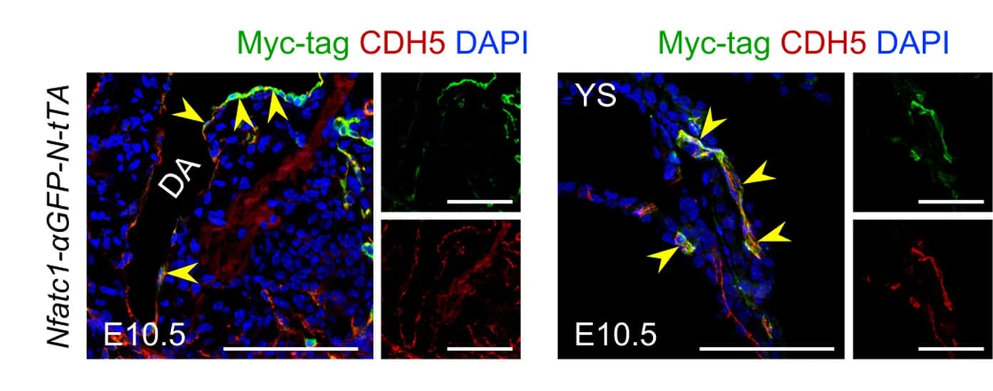 Open access visualization of Microscopy, Immunostaining, Myc-tag, CDH5, E10.5 Embryonic Sections