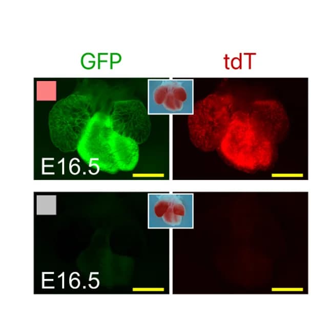 Open access visualization of Microscopy, Photo, Whole-Mount Fluorescence, E16.5 Hearts, CM-Endo-gTCCC Mice