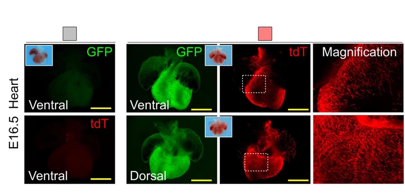 Open access visualization of Microscopy, Photo, Whole-mount fluorescence, E16.5 hearts, gTCCC mice