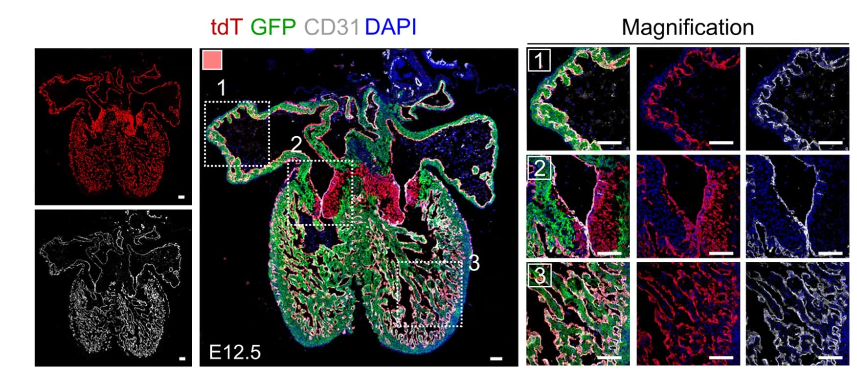 Open access visualization of Microscopy, Immunostaining, Heart Sections, tdT, GFP