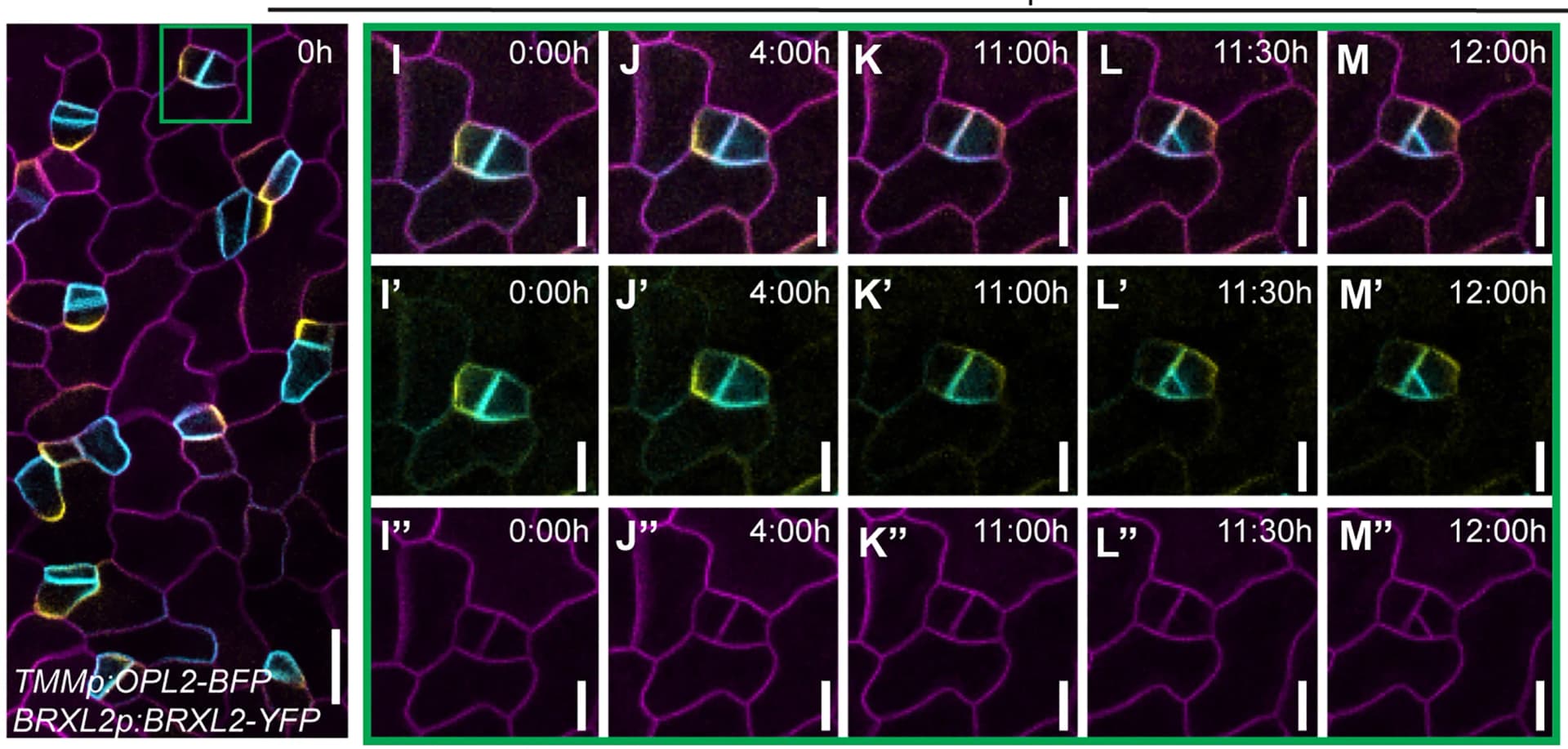 Open access visualization of Microscopy, Time-Lapse Imaging, ACD, OPL2, BRXL2