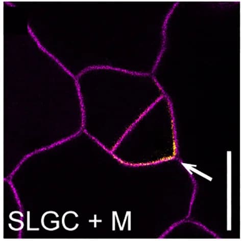 Open access visualization of Microscopy, OPL2-VENUS, Polarity, Developmental Stages, Stomatal Lineage