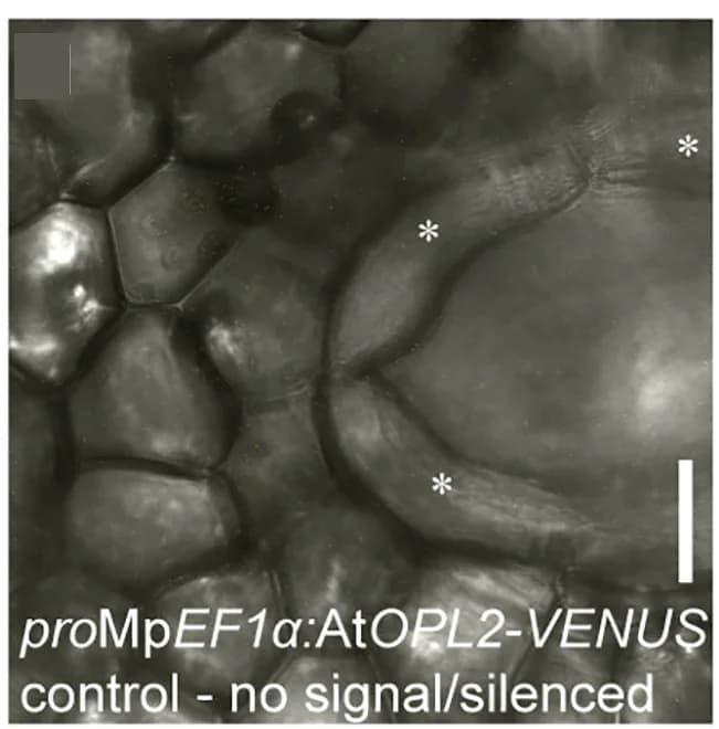 Open access visualization of Microscopy, Marchantia, Gene Expression, Transgene Silencing, Cell Differentiation