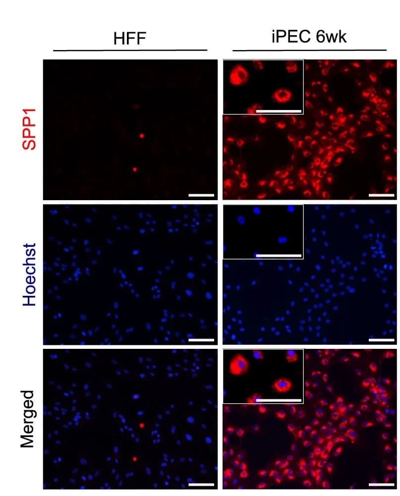 Open access visualization of Microscopy, Immunofluorescence, SPP1, DNA, Hoechst