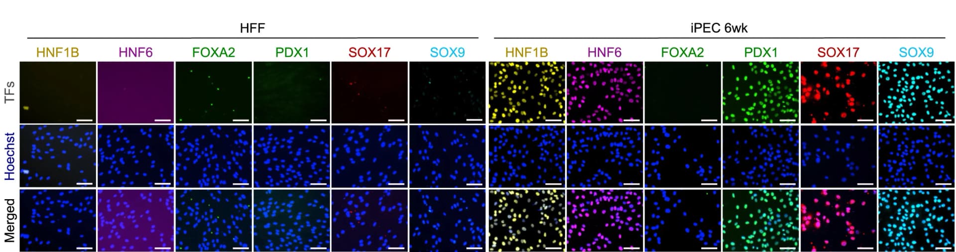 Open access visualization of Microscopy, Immunofluorescence Staining, Transcription Factors, HFFs, iPEC