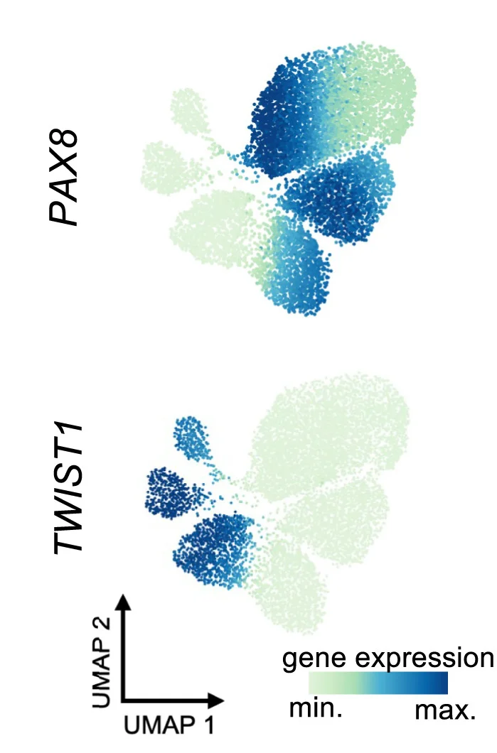 Open access visualization of UMAP, Scatter Plot, Cells, PAX8 Gene Expression, TWIST1 Gene Expression