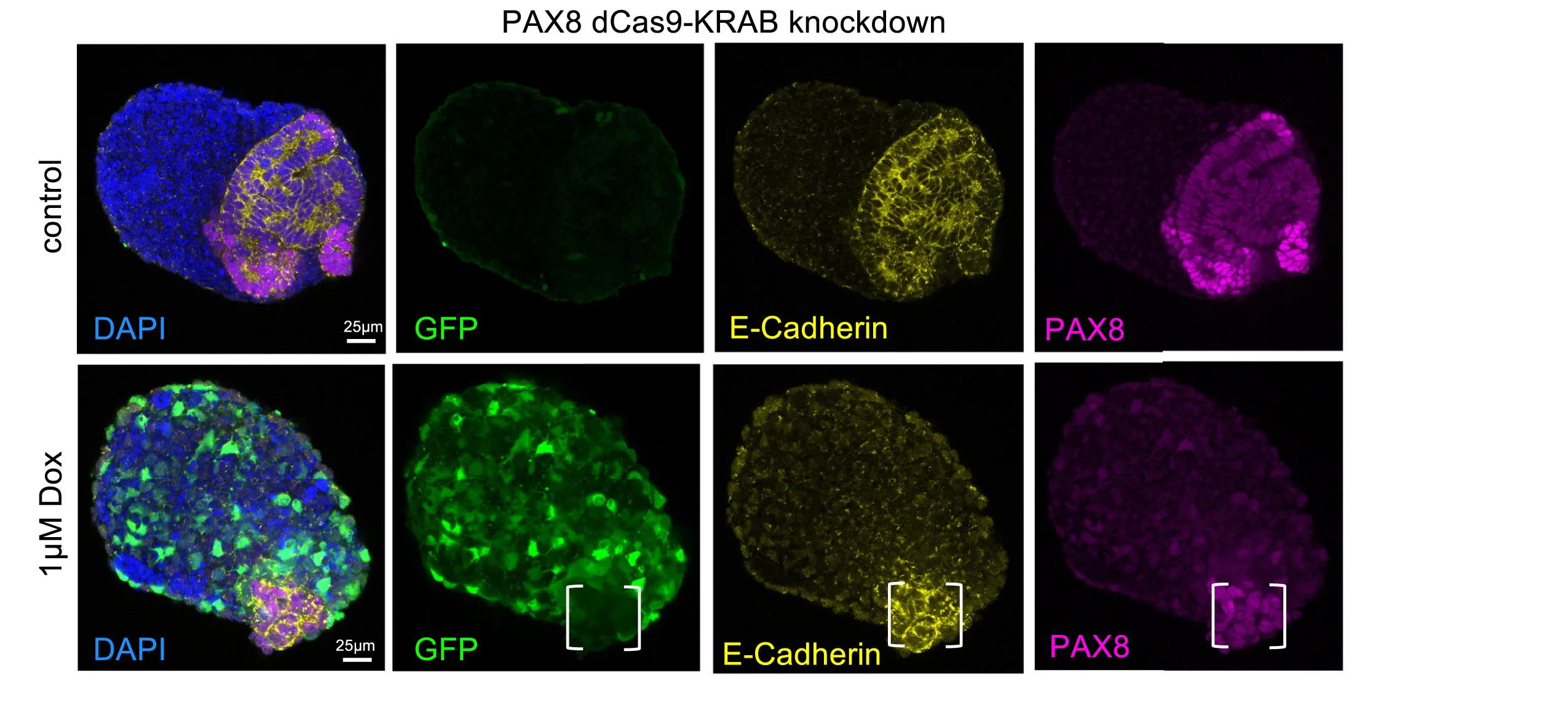 Open access visualization of Microscopy, Immunofluorescence, Organoids, iPSCs, Dox Treatment