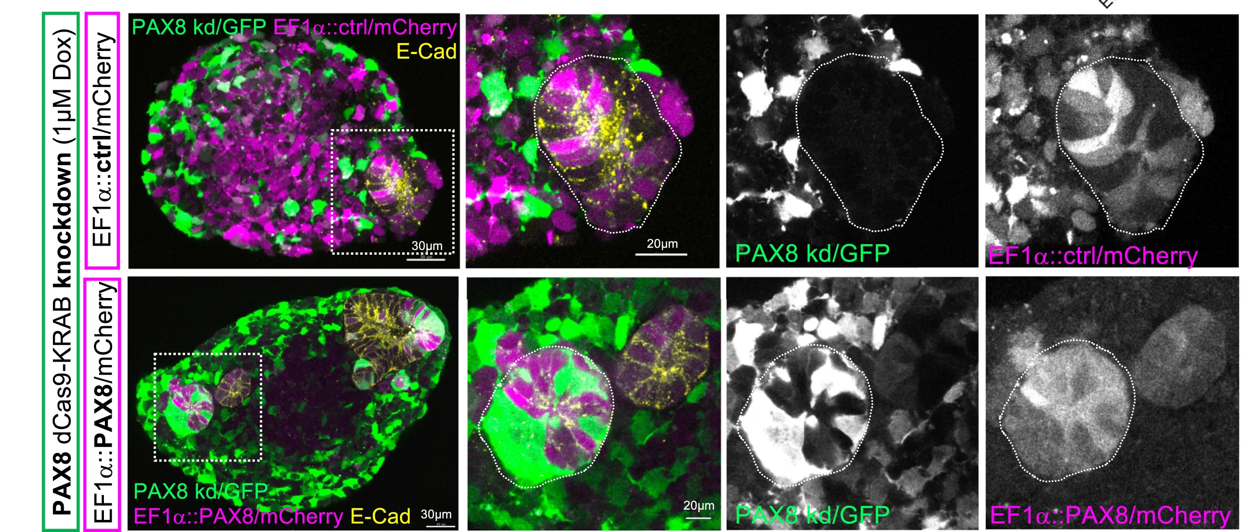 Open access visualization of Microscopy, MET Rescue, PAX8 Knockdown, Lentiviral Overexpression, Immunofluorescence
