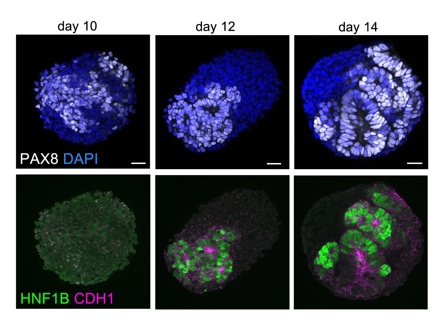 Open access visualization of Microscopy, Immunofluorescence, Organoids, PAX8, DAPI