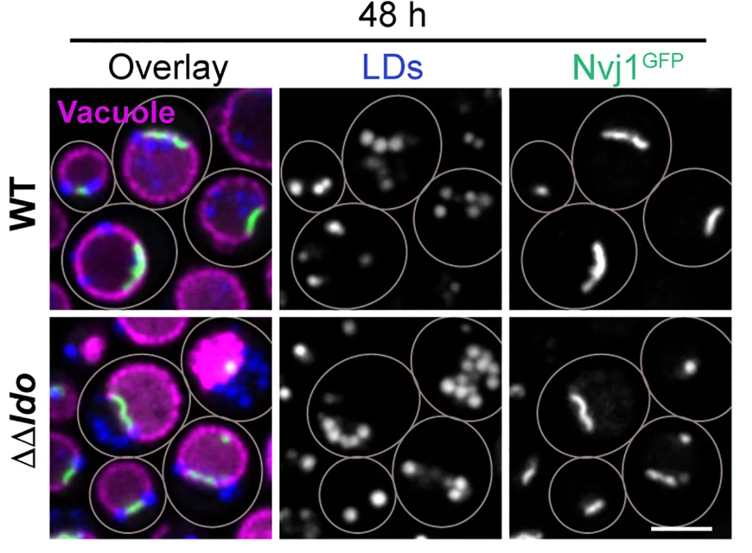 Open access visualization of Microscopy, Micrographs, Nvj1GFP, Vph1mCherry, MDH
