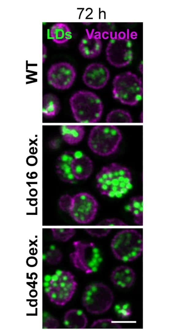 Open access visualization of Microscopy, Micrographs, Ldo45 Overexpression, Ldo16 Overexpression, Vph1mCherry
