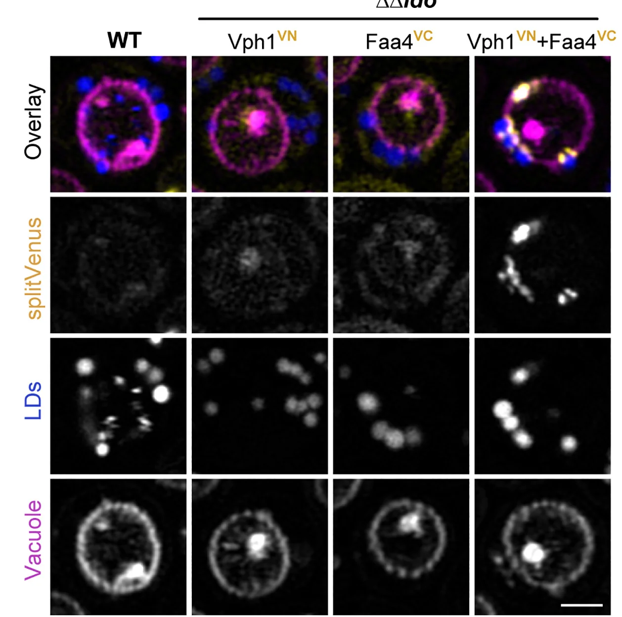 Open access visualization of Microscopy, Micrographs, Wild Type, ΔΔldo Cells, SplitVenus Fragments