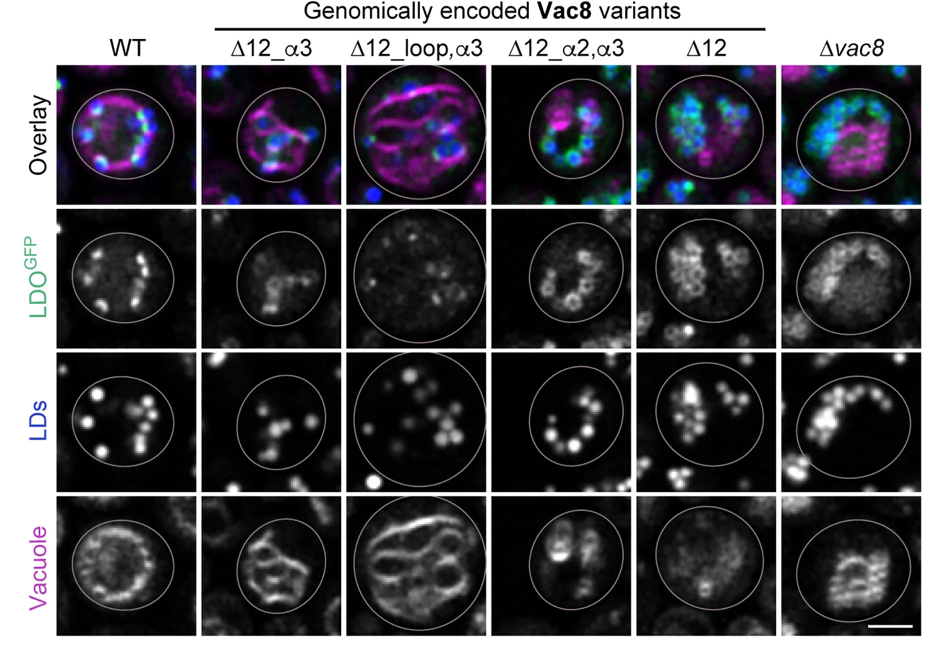Open access visualization of Microscopy, Wild-Type, Δvac8, Cells, Vac8 Variants
