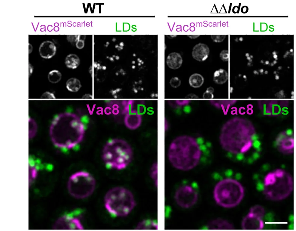Open access visualization of Microscopy, Wild-Type, ΔΔldo Cells, Vac8mScarlet, BODIPY493/503