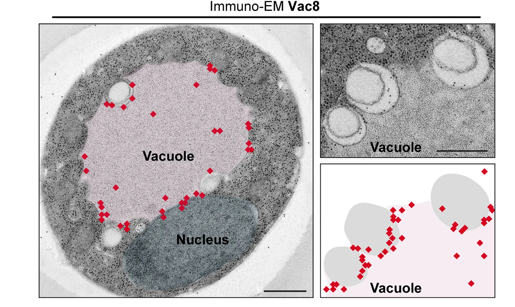 Open access visualization of Microscopy, Electron Micrographs, Immunogold Labeling, WT Cells, Vac8 Antibody