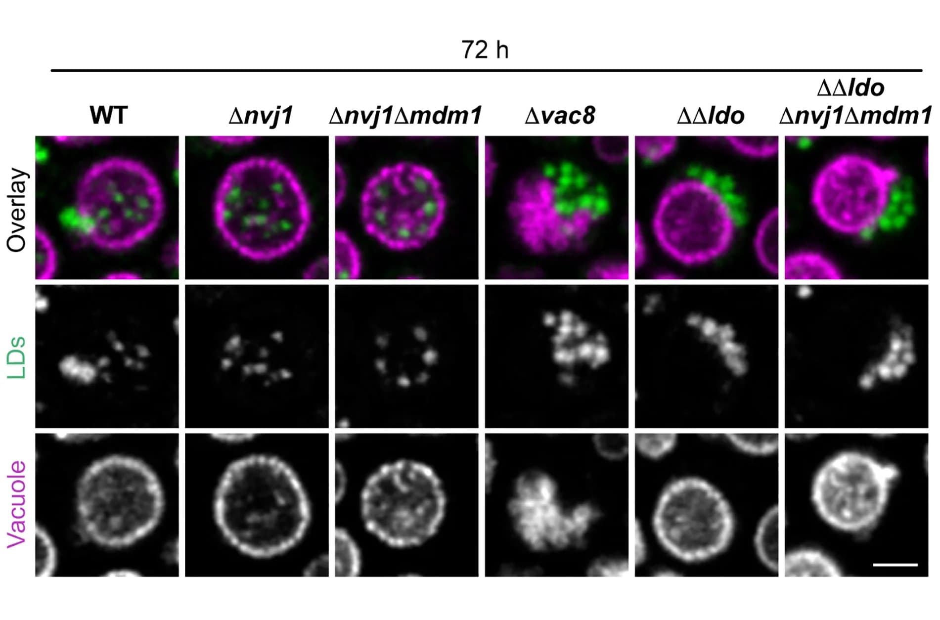 Open access visualization of Microscopy, Micrographs, Vph1mCherry, BODIPY493/503