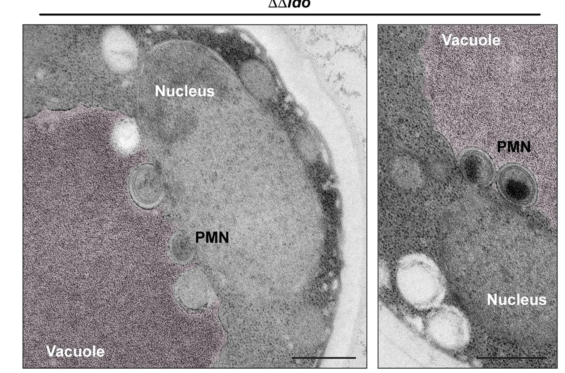 Open access visualization of Microscopy, Electron Micrographs, Piecemeal Microautophagy, Nucleus