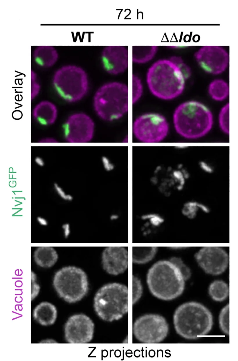 Open access visualization of Microscopy, Z Projections, Nvj1GFP, Vph1mCherry, PMN Vesicles