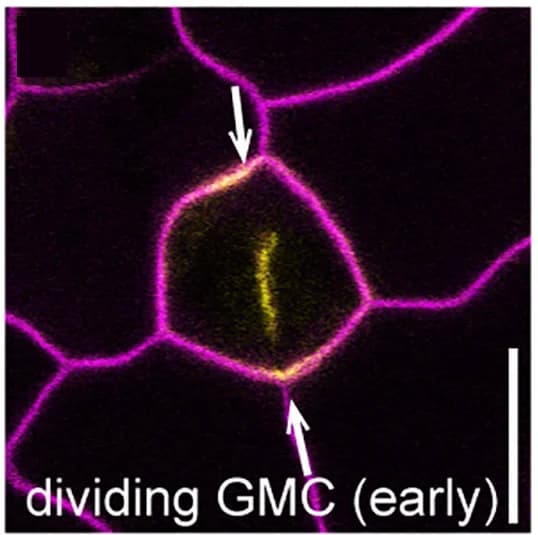 Open access visualization of Microscopy, OPL2-VENUS, Cell Plate, Cell Division, Polar Patches