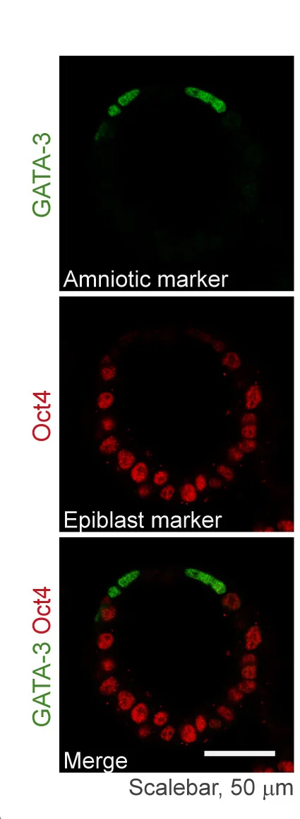 Open access visualization of Microscopy, Confocal Imaging, PASE, Primitive Streak, Amniotic Marker GATA-3