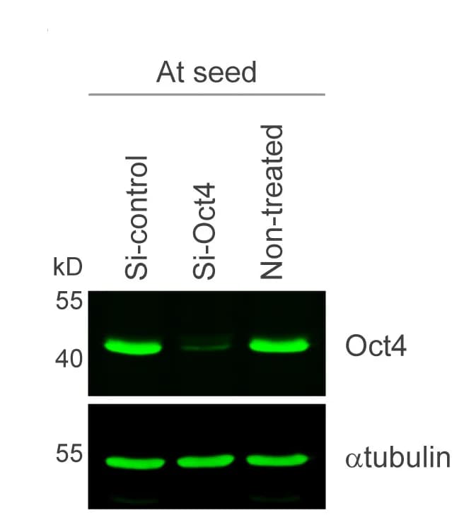 Open access visualization of Gel, Immunoblot, Oct4, Knockdown Efficiency, alpha-tubulin