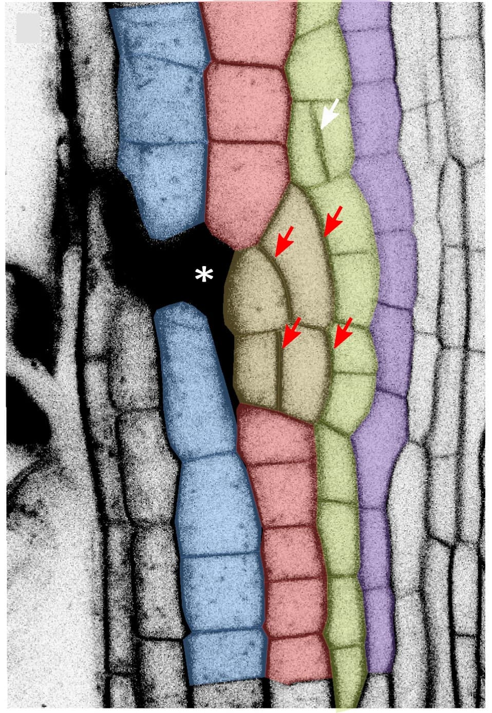 Open access visualization of Microscopy, Periclinal Divisions, Wound-Adjacent Cells, Endodermis