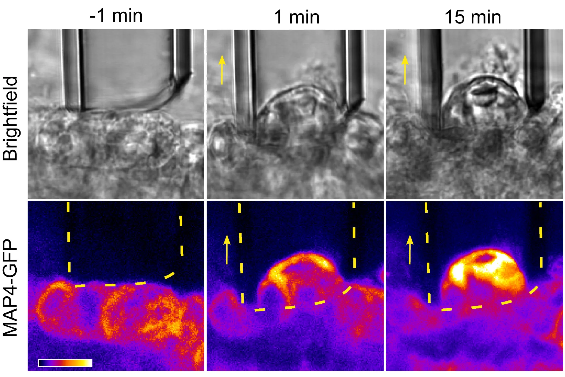 Open access visualization of Microscopy, Epidermal Cells, Brightfield, Fluorescence, Aspiration