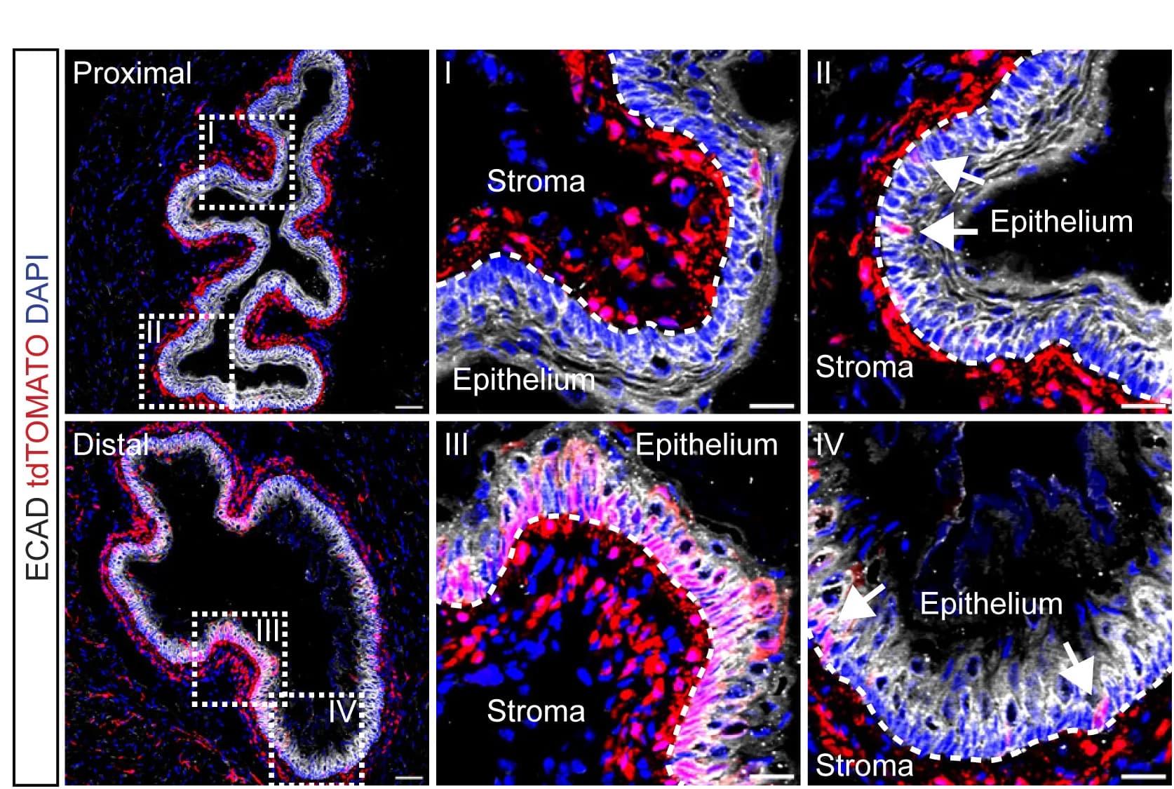 Open access visualization of Microscopy, Cross Sections, Proximal Esophagus, Distal Esophagus, tdTOMATO Reporter Expression