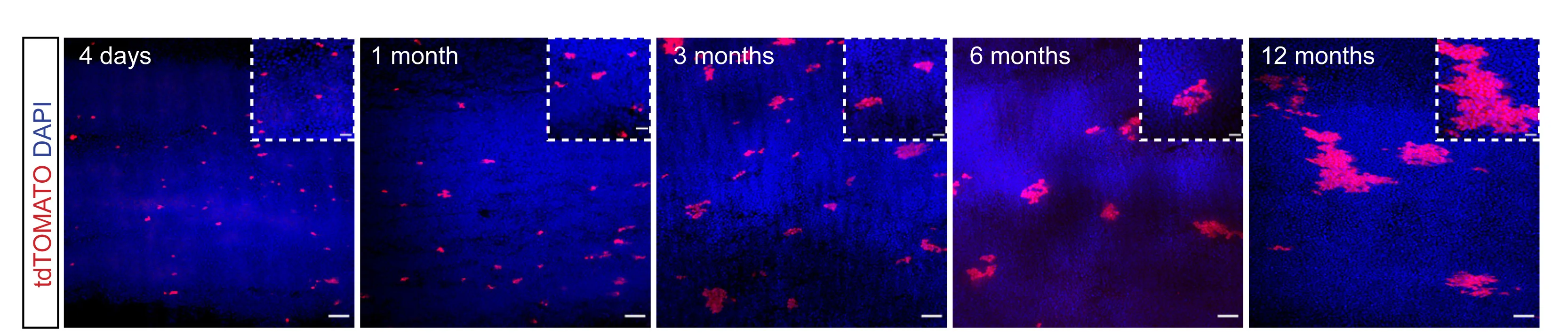 Open access visualization of Microscopy, Lineage Tracing, Troy-CreERT2:tdTomato Mice, Time Course